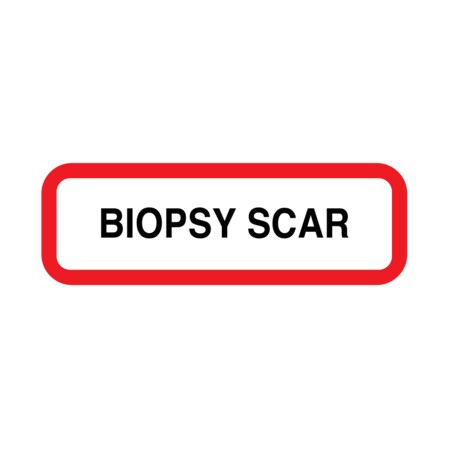 Nevs Position Labels - Biopsy Scar 1/2" x 1-1/2" White w/Red & Black XP-105